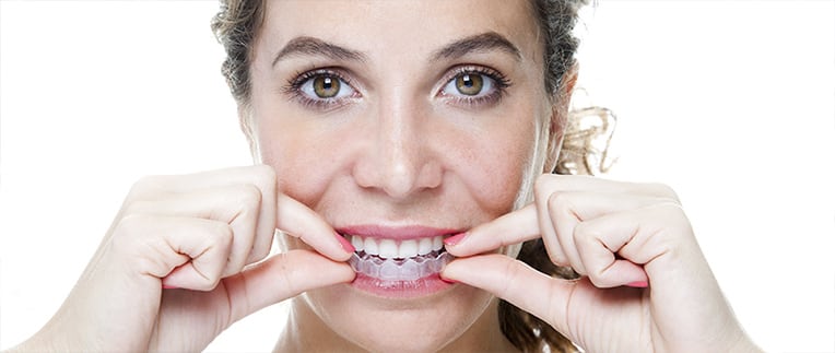 Invisalign Southpointe Dental Red Deer